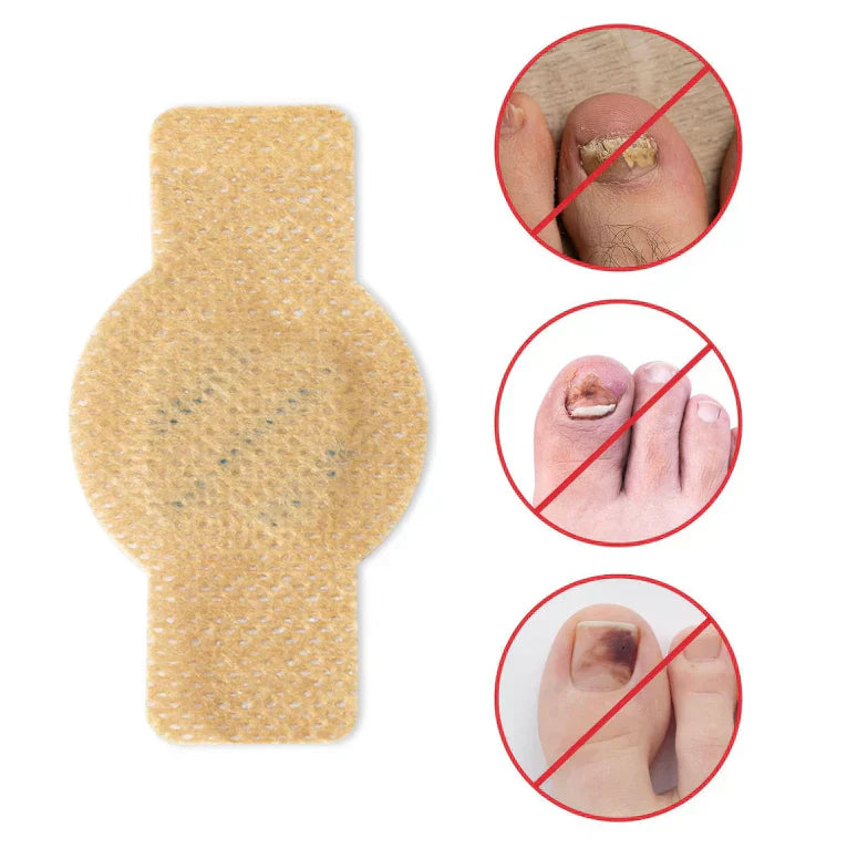 FungalNail™ 21 Parches Antihongos | 2x1