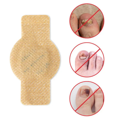 FungalNail™ 21 Parches Antihongos | 2x1