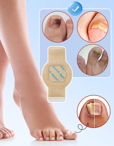 FungalNail™ 21 Parches Antihongos | 2x1